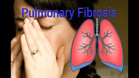 Pulmonary Fibrosis