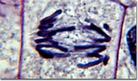 Molecular Expressions Photo Gallery: Mitosis - Early Anaphase