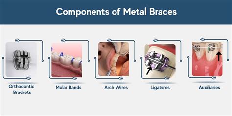 Metal Braces: Pros, Cons and Alternatives