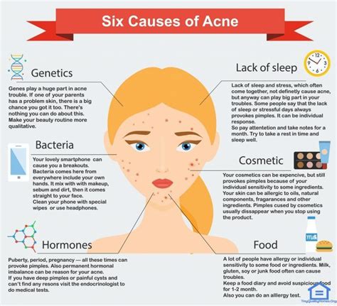 41 Health Benefits Of Almonds | Acne causes, Acne, Acne treatment