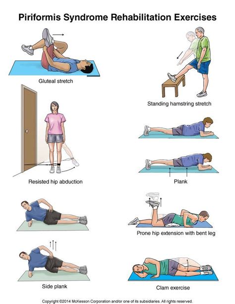 Summit Medical Group | Piriformis syndrome exercises, Piriformis syndrome, Piriformis