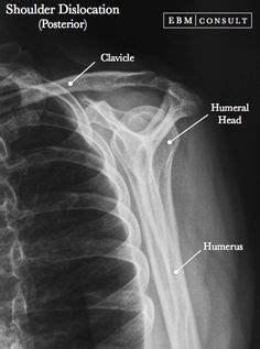 12 X Rays & Radiology ideas | radiology, radiology student, medical anatomy