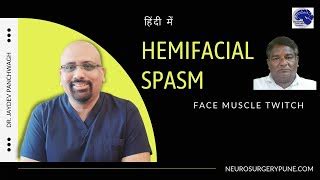 Hemifacial spasm. Face muscle twitch. Treatment in Indi... | Doovi