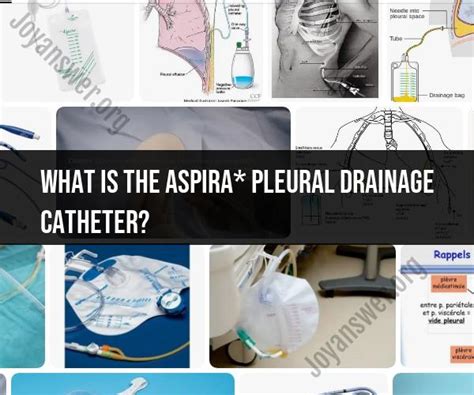 ASPIRA* Pleural Drainage Catheter: Overview and Usage - JoyAnswer.org