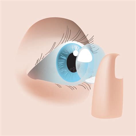 Realistic Style Vector Illustration with Eye and Contact Lens Stock ...