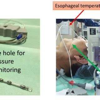 Esophageal pressure monitoring system combined with the esophageal ...