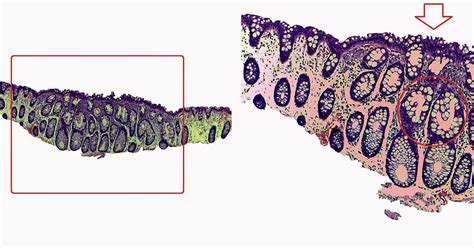 GASTROINTESTINAL AND LIVER HISTOLOGY PATHOLOGY ATLAS: COLON ...