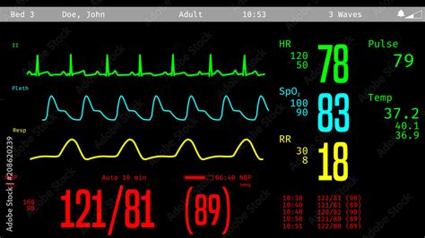 Vital Signs | How To Measure and What’s the Normal Range