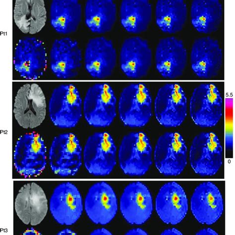 Super-resolution magnetic resonance spectroscopic imaging (MRSI)... | Download Scientific Diagram