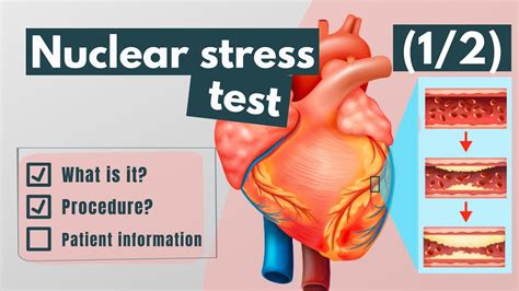 Test Stress