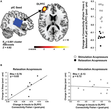Frontiers | Brain Connectivity Patterns Dissociate Action of Specific Acupressure Treatments in ...