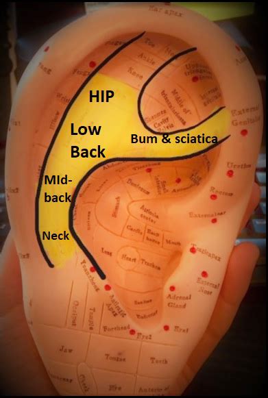 Acupuncture Ear Seed Demo | Back and Neck Pain - Aligned Modern Health