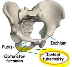 ischial tuberosity Anatomy, Location, Pain, Treatment, Causes. Ischial tuberosity has two parts ...