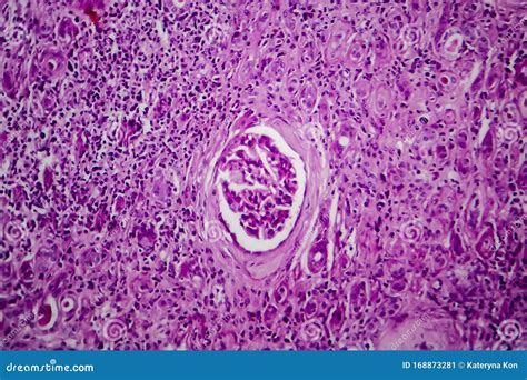 Glomeruli Histology