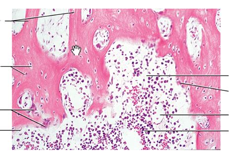 Long Bone Cross Section Bone Cross Section Lm Photograph By Science | The Best Porn Website