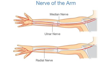 Radial Tunnel Syndrome: Causes, Symptoms, and Treatment