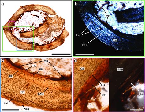 Histology reveals the presence of small amounts of medullary bone (MB)... | Download Scientific ...