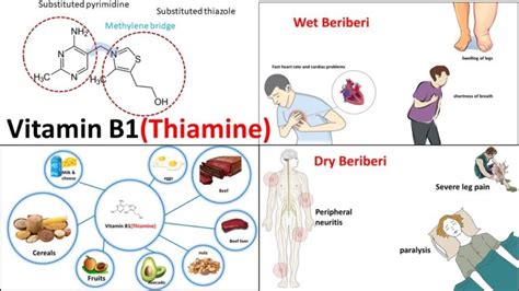 Benefits of Thiamine (Vitamin B1) » The Nutraceutical Database