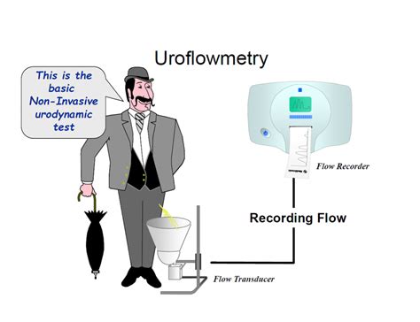 Urodynamics / Urodynamic Study - Urology Malaysia