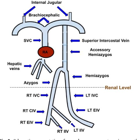 Figure 3 from Interrupted inferior vena cava syndrome discovered incidentally after minimally ...