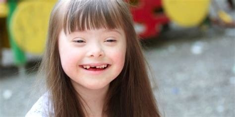 Information about Silver-Russell syndrome - One of 200 types of dwarfism | Body & Health ...