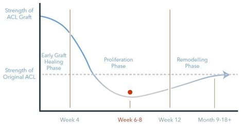 The Complete Guide to ACL Tear Rehab | Kinetic Labs