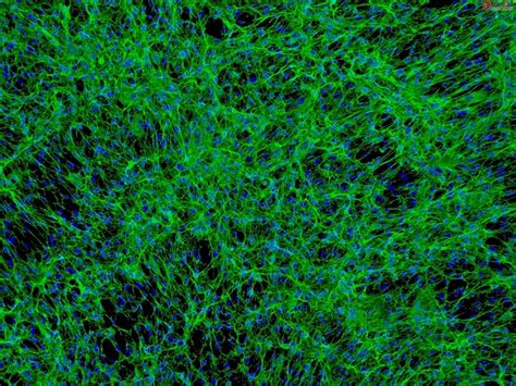 Human Pancreatic Stellate Cells