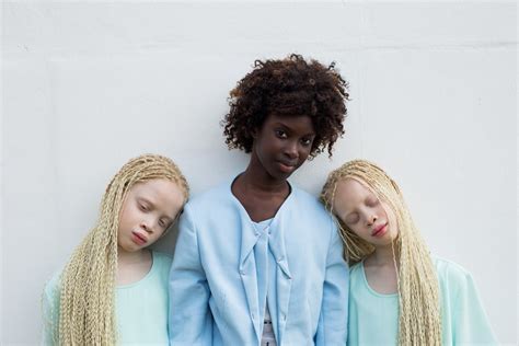 The Brazilian albino twins dreaming of big things in fashion | Dazed