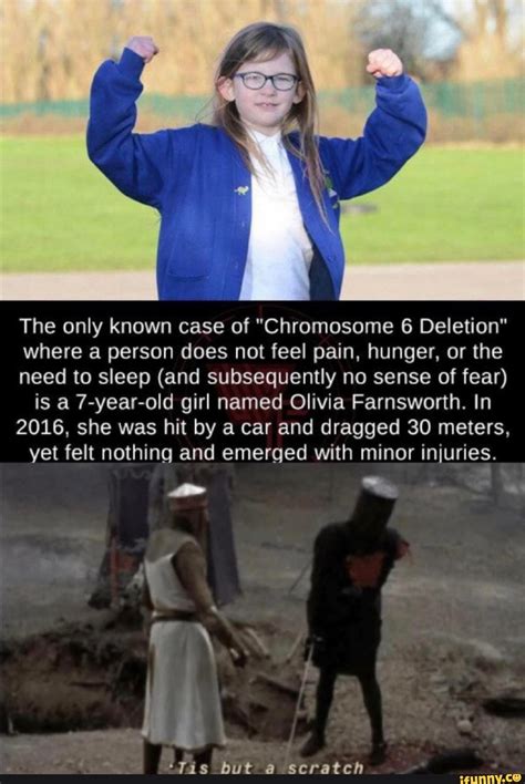 The only known case of "Chromosome 6 Deletion" where a person does not feel pain, hunger, or the ...