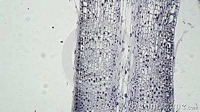 Root Tip of Allium Cepa in Longitudinal Section Magnified by Microscope ...