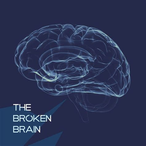 The Broken Brain | Listen via Stitcher Radio On Demand