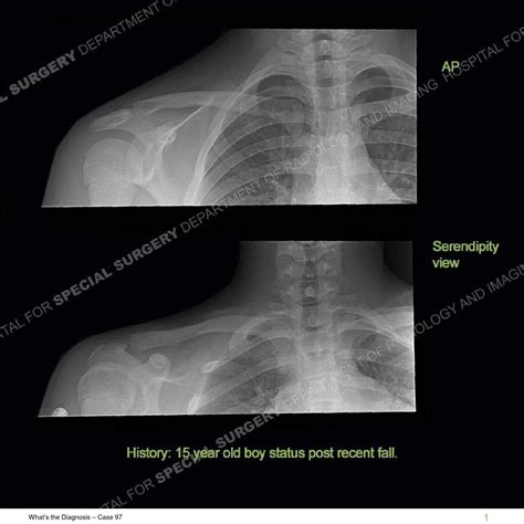 HSS What's the Diagnosis Case 97 by Hospital for Special Surgery - Issuu