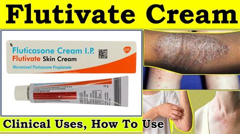 Floticasone cream uses and how to use - flutivate cream uses in hindi, Side effects, Dose - YouTube