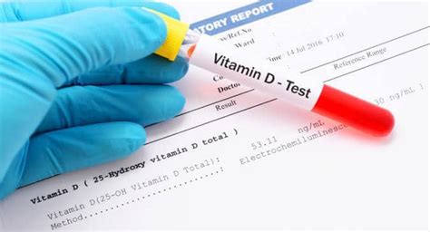 Vitamin D deficiency test -- Everything you wanted to know about this blood test | TheHealthSite.com