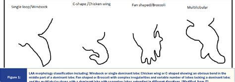 Figure 1: LAA morphology classification including: Windsock or single dominant lobe; Chicken ...