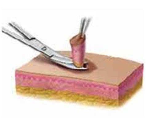 Dentistry and Medicine: Principles and Techniques of Biopsy