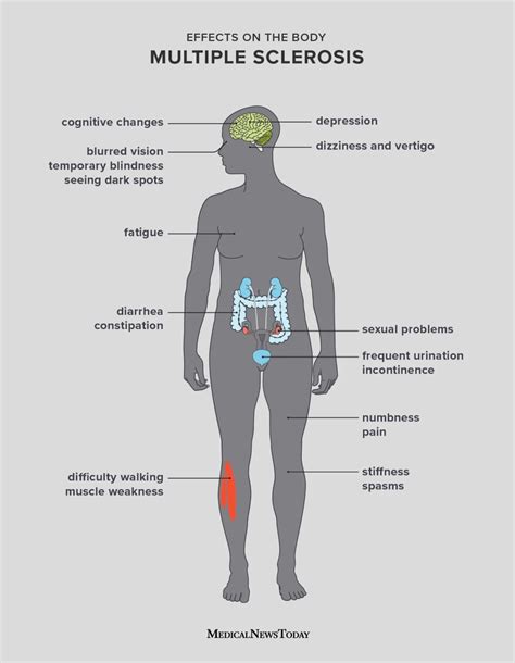 What Are The Symptoms Of Ms