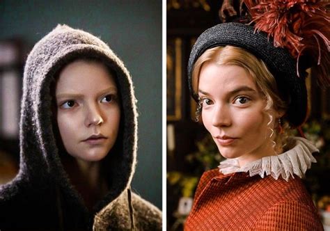 Anya Taylor-Joy Before and After Plastic Surgery