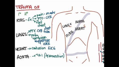 Trauma 03 - Blunt Chest Trauma - YouTube