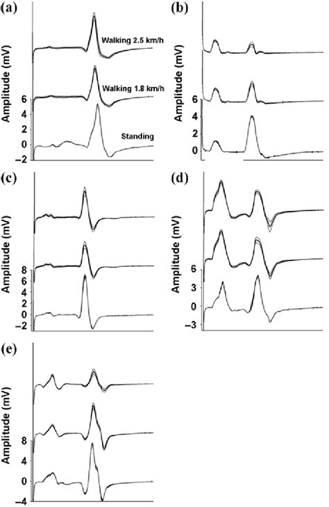 Signal-averaged H reflex cycles. Presented are typical subjects (a)... | Download Scientific Diagram