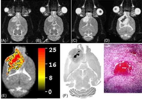 Antivascular effect of sterically stabilized liposomes encapsulating... | Download Scientific ...