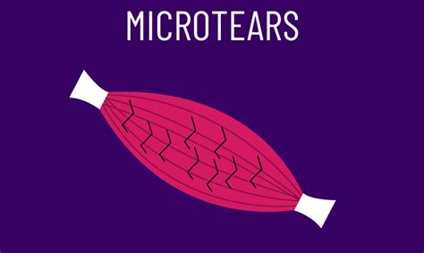 Do Microtears in the Muscle Cause Growth? Science Analysis - House of ...