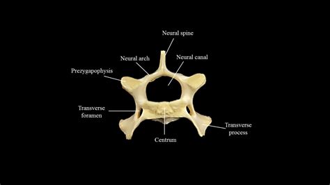 Cat vertebral column | Atlas of Comparative Vertebrate Anatomy