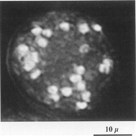 Nuclei in a chlamydospore. Chlamydospores were stained with DAPI and... | Download Scientific ...