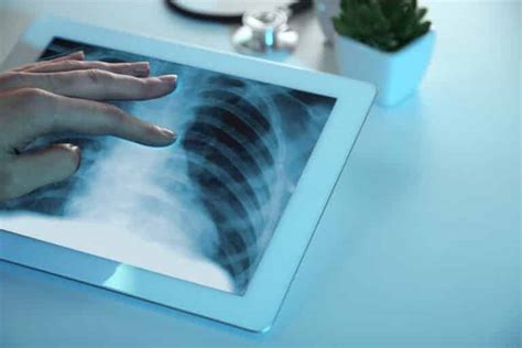 History Of Digital Radiography And X-ray | Nano Medic Care