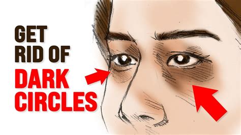 What Causes Dark Circles Under Eyes? Dr. Berg