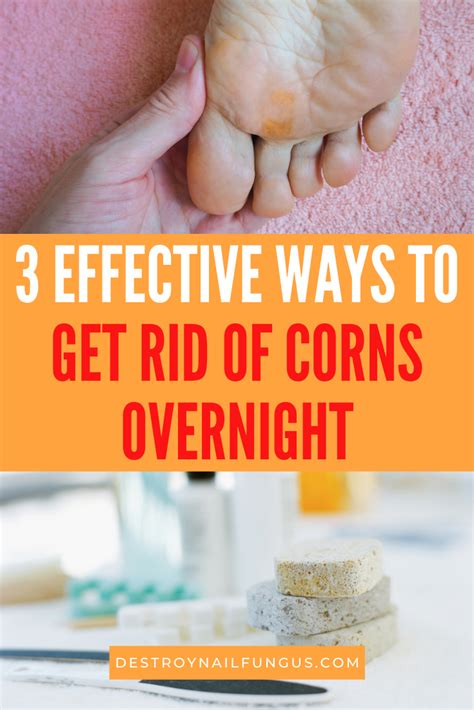 3 Ways On How To Remove Corns On Your Feet Overnight