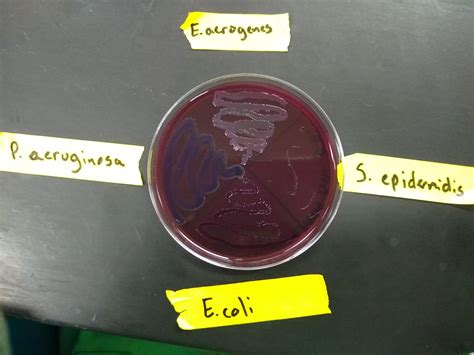 Eosin Methylene Blue Agar Positive Results - cristina-ezvagyoken