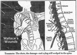 Presidential Candidate George Wallace is Shot 4 Times in an ...