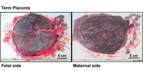 Lecture - Placenta Development - Embryology